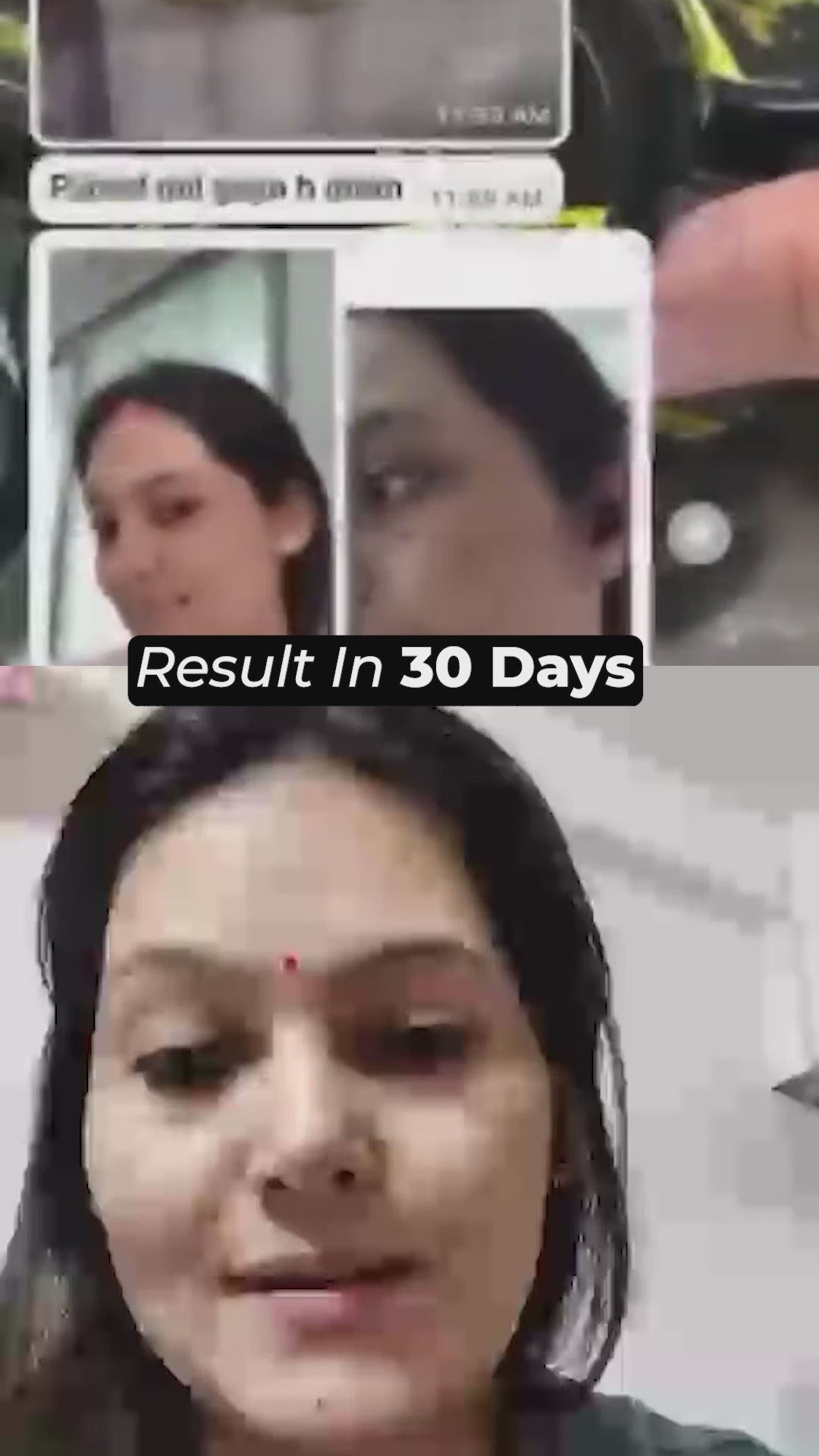 Special Pigmentation & Glow Combo