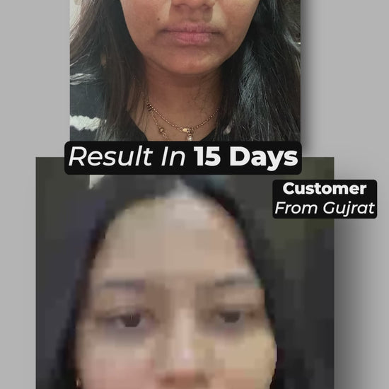 Ad 5 - Pigmentation_1.mp4