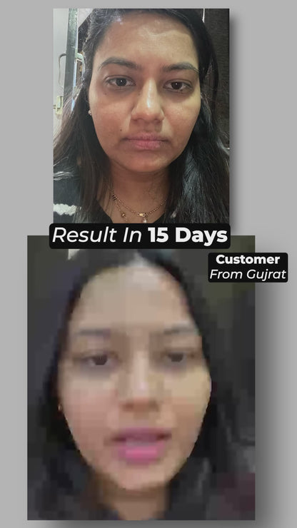 Ad 5 - Pigmentation_1.mp4