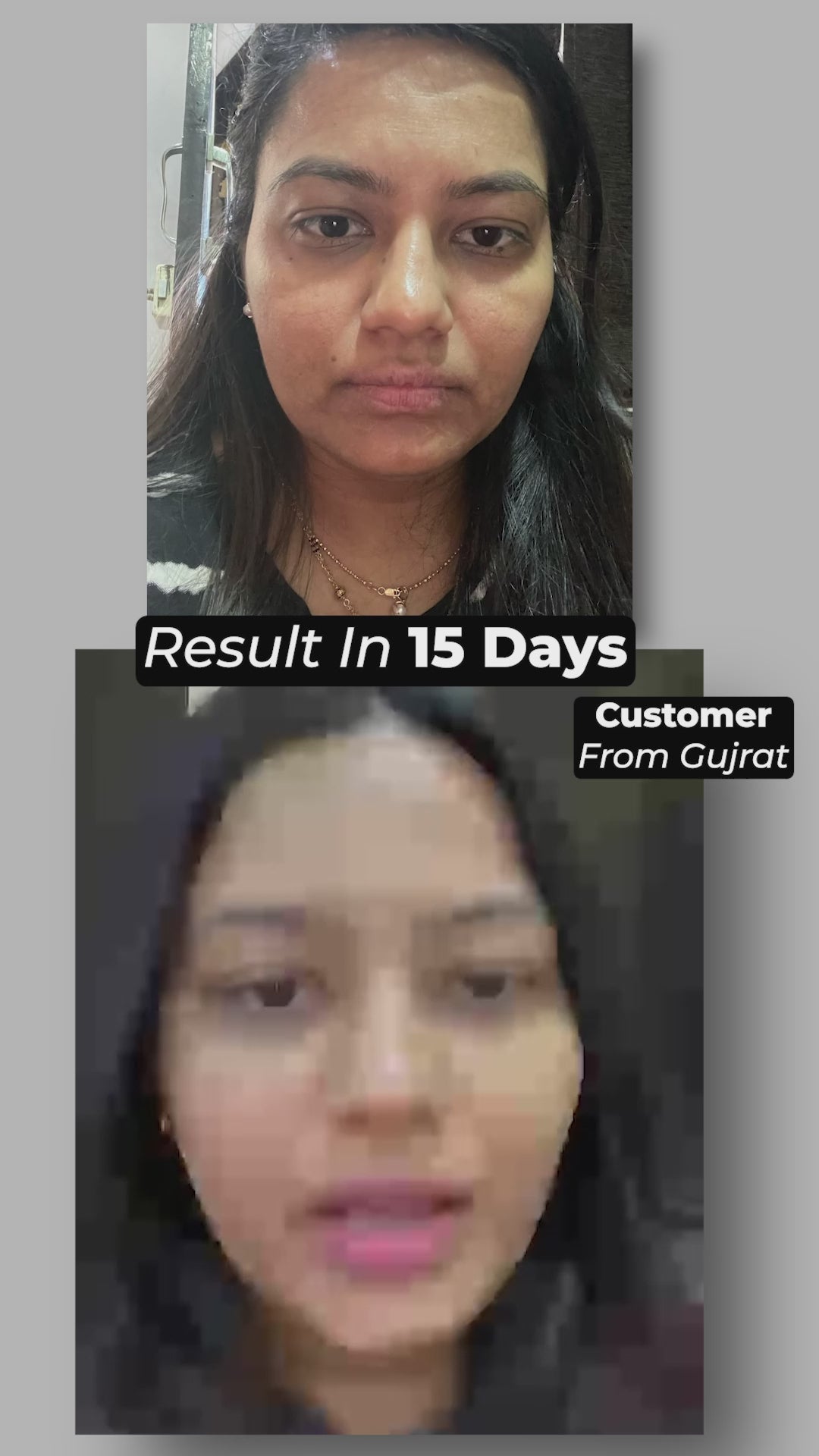 Ad 5 - Pigmentation_1.mp4