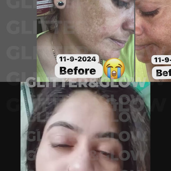 Ad  8 - Pigmentation watermark.mp4