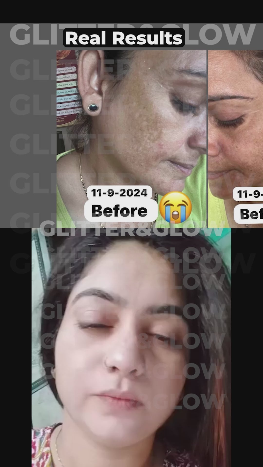 Ad  8 - Pigmentation watermark.mp4