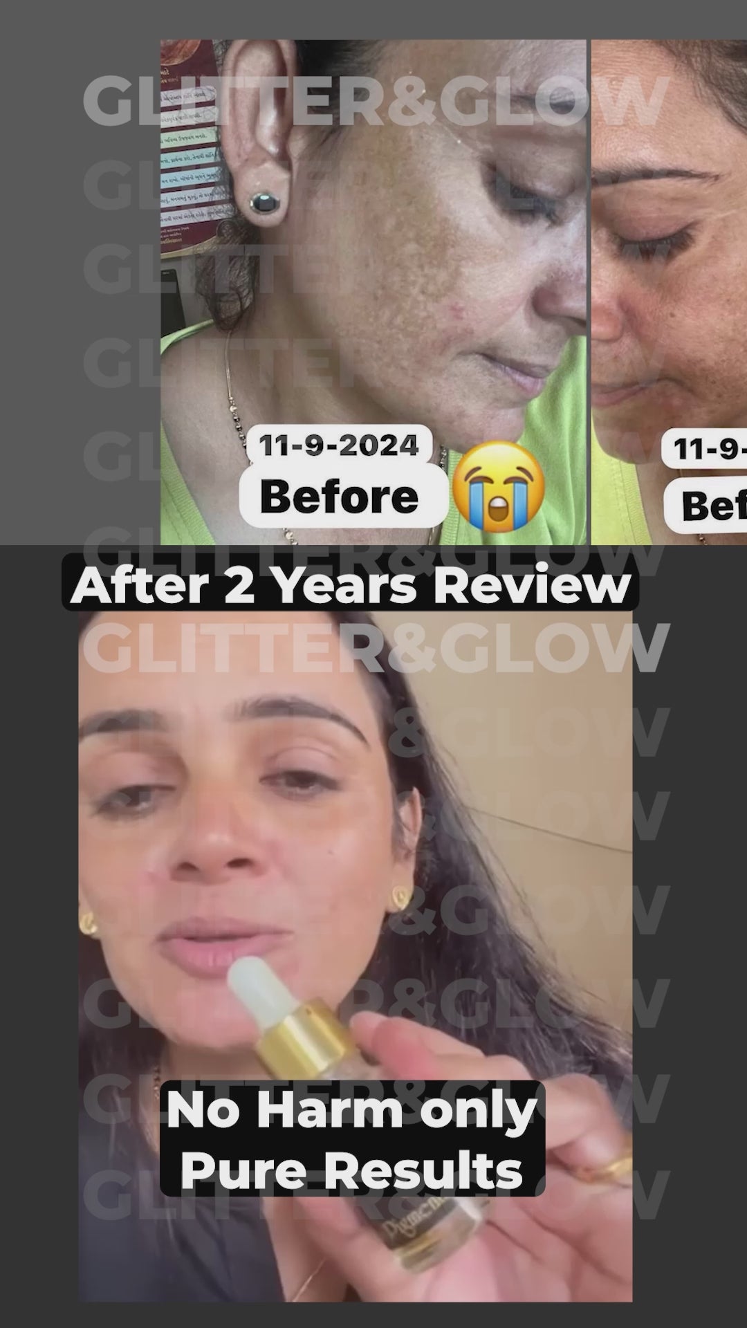 Ad 6 - Pigmentation_Watermark.mp4