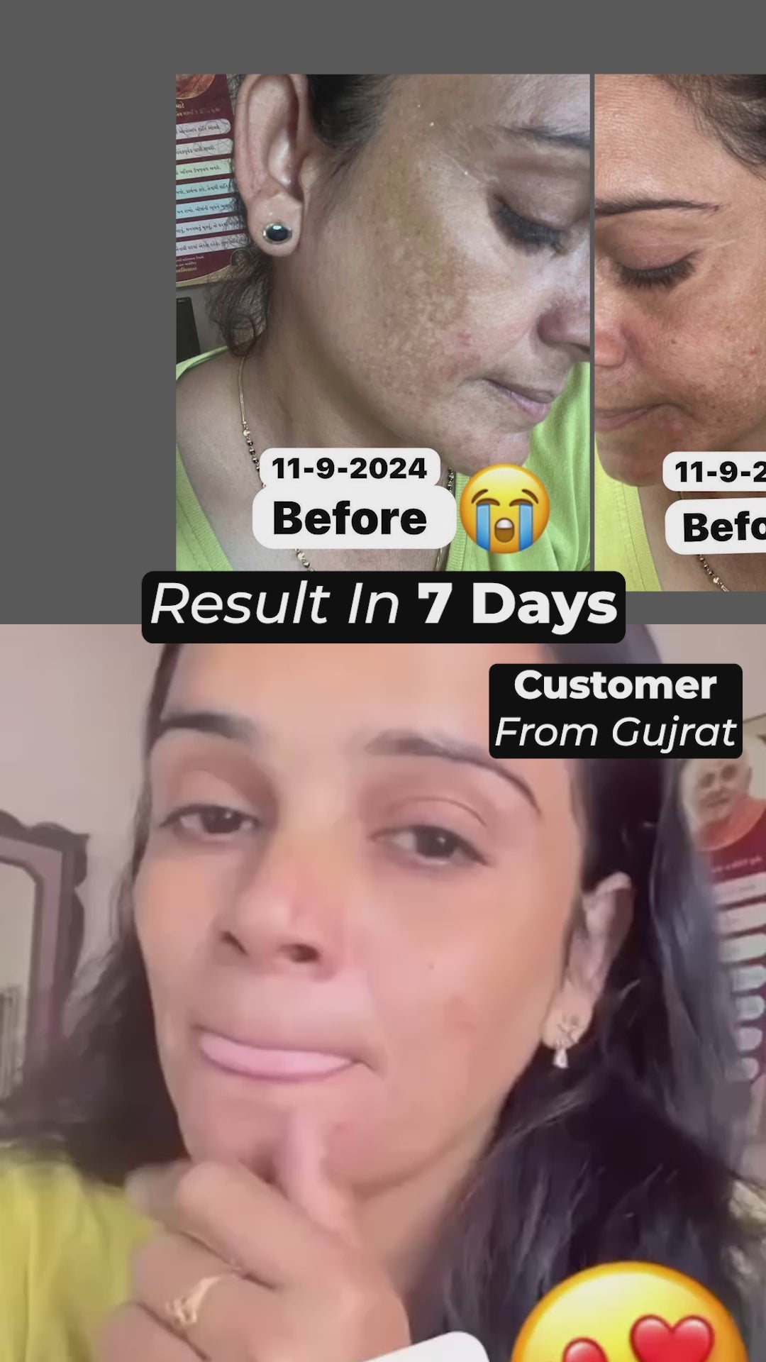 Special Pigmentation & Glow Combo