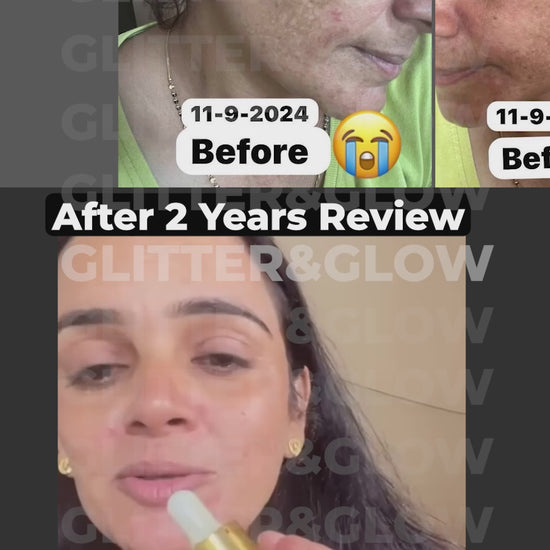 Ad 6 - Pigmentation_Watermark.mp4