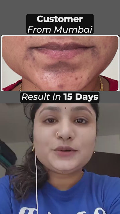 Special Pigmentation & Glow Combo