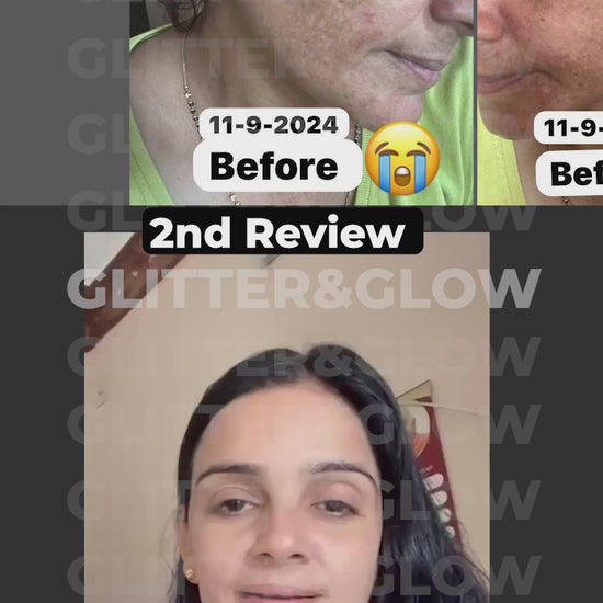 Ad 7 - Pigmentation.mp4