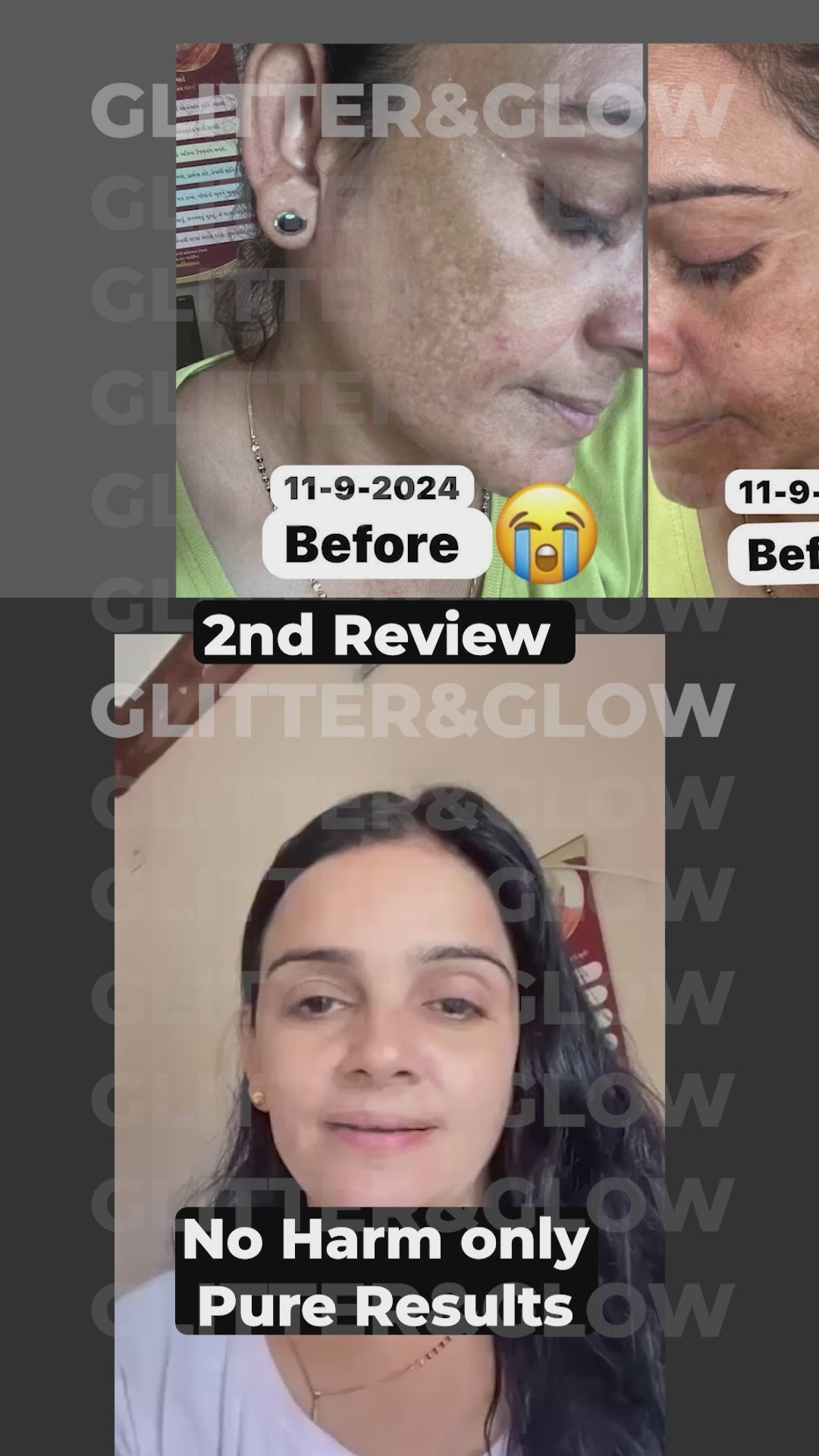 Ad 7 - Pigmentation.mp4