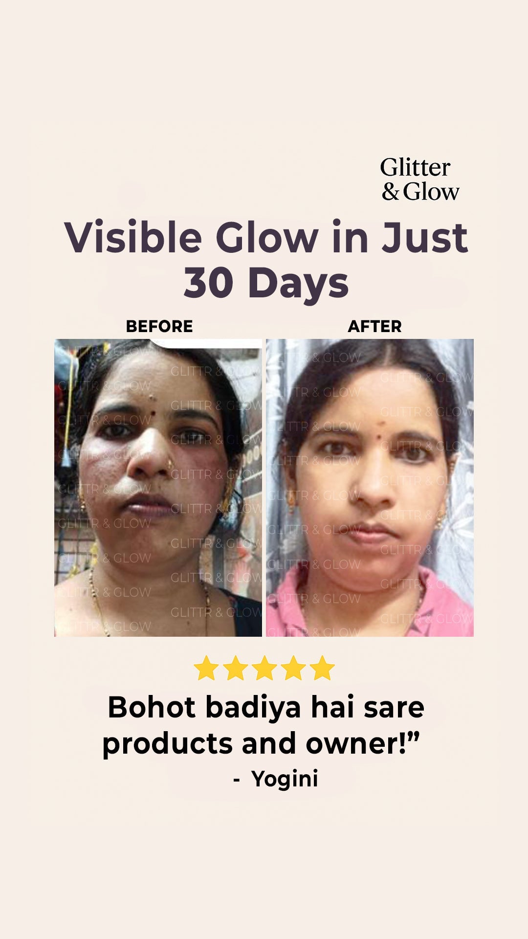 Special Pigmentation & Glow Combo - Glitter and Glow