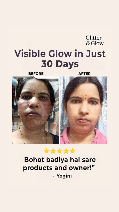 Special Pigmentation & Glow Combo - Glitter and Glow