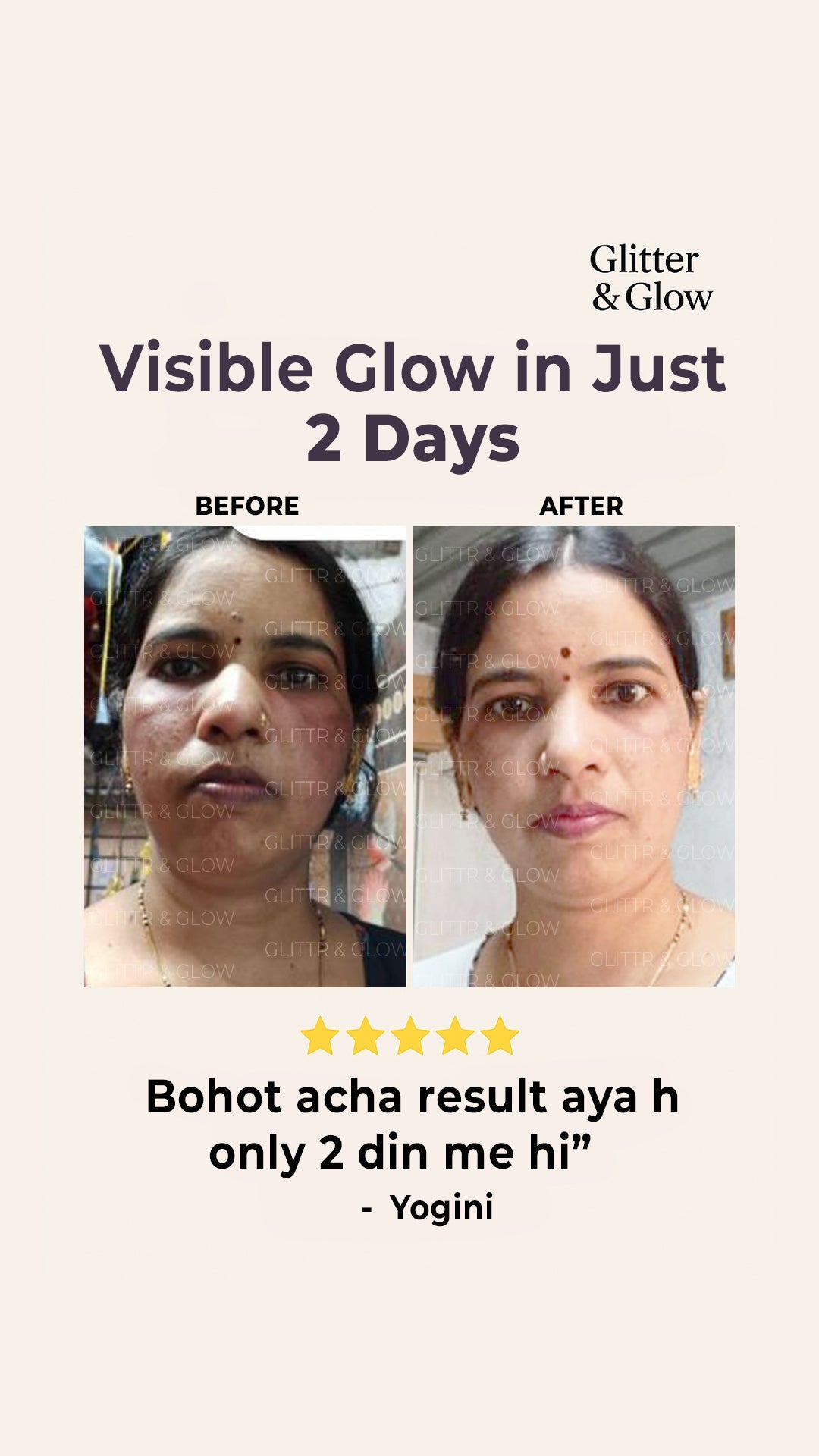 Special Pigmentation & Glow Combo - Glitter and Glow