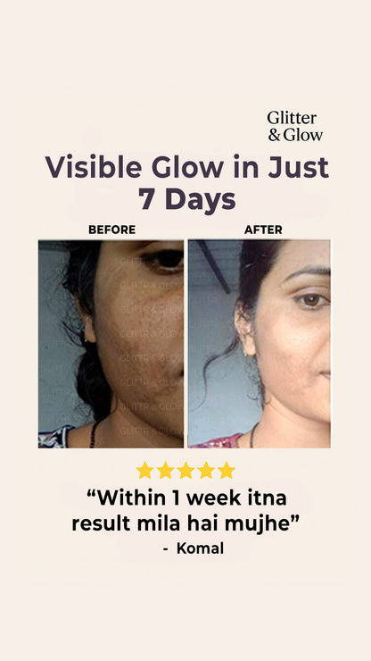 Special Pigmentation & Glow Combo - Glitter and Glow