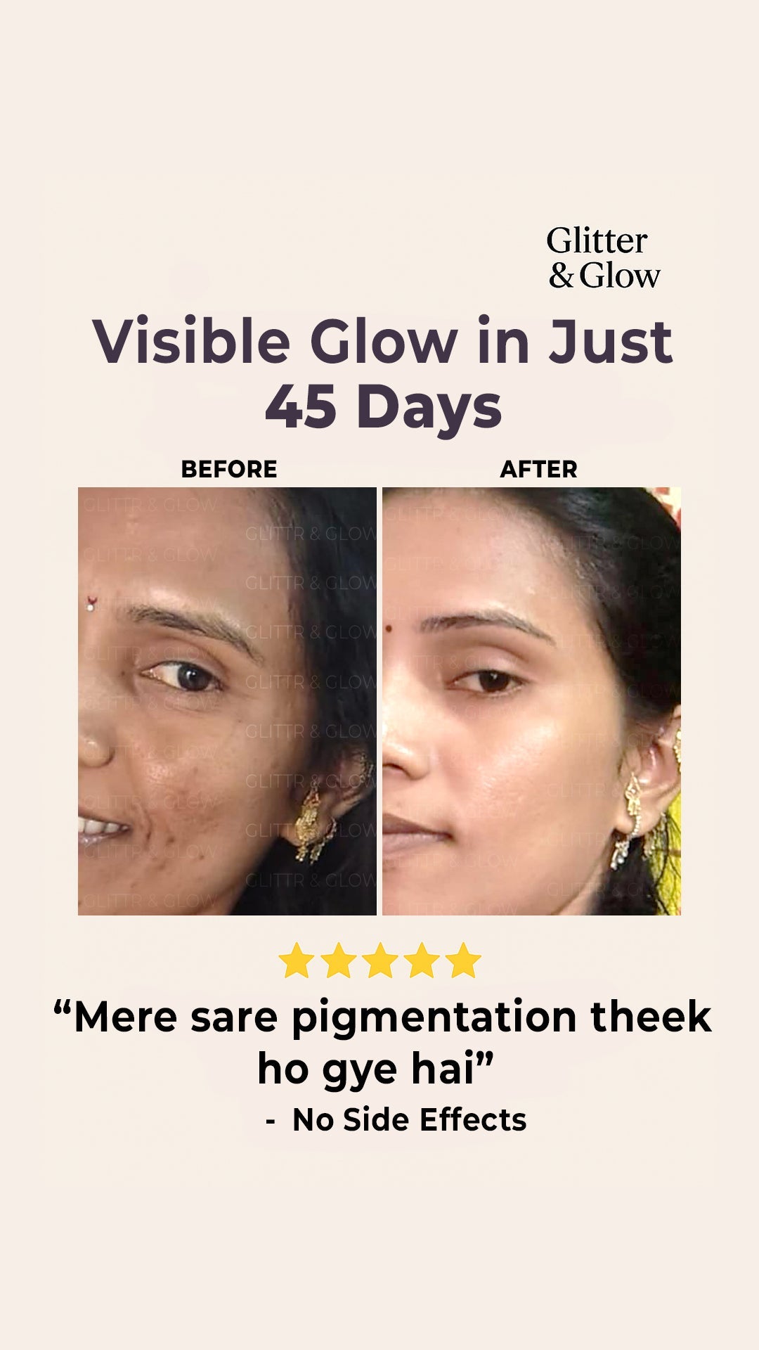 Special Pigmentation & Glow Combo - Glitter and Glow